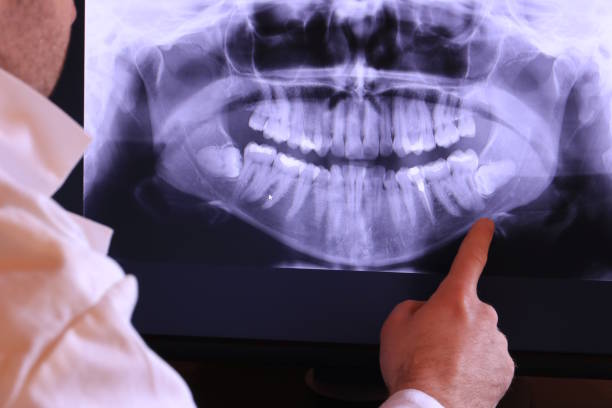 Best Broken Tooth Emergency  in Camilla, GA